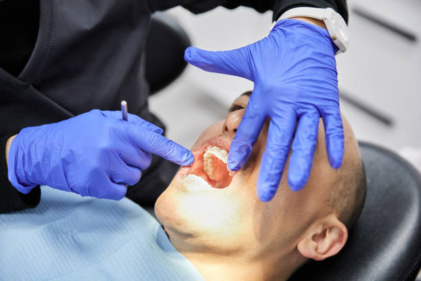 Best Emergency Dentist for Lost Fillings or Crowns in Simi Valley, CA